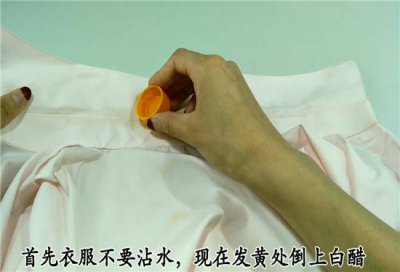 ​衣服发黄怎么洗白小妙招 衣服发黄了用什么洗才能去黄