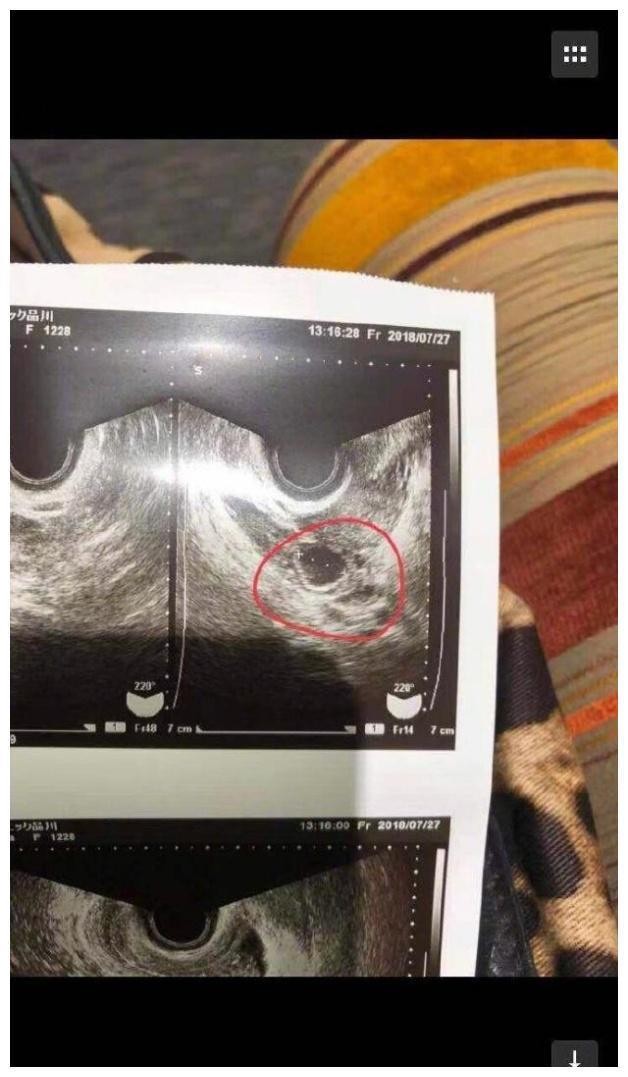 蒋劲夫家暴原因疑曝光,女友假怀孕骗婚骗房,女友母亲是黑社会