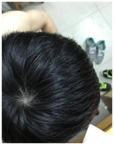 ​你头顶几个旋？有三个的不是一般人！飞黄腾达没问题