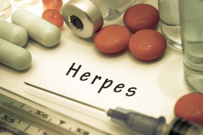 ​生殖器疱疹是性病吗 生殖器疱疹是性病很可怕？别慌，做好这5点让它绕着走
