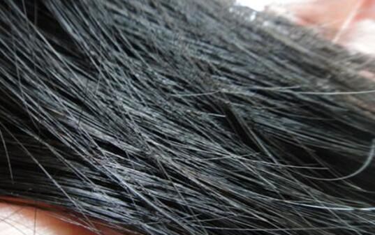 2天不洗头头皮一大堆，去掉头油头皮屑，使用哪几个生活小妙招