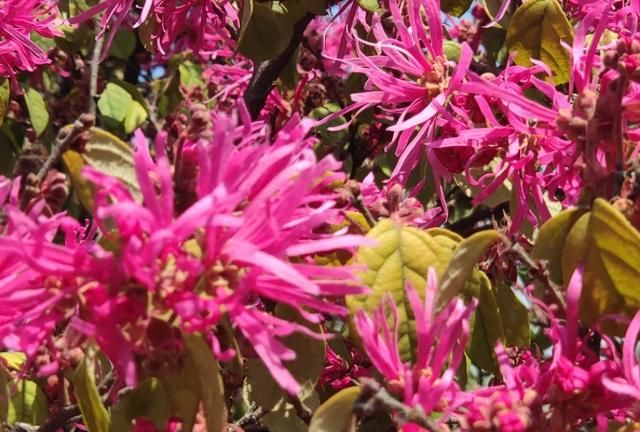 怎样去头油，2天不洗头头皮一大堆，去掉头油头皮屑，使用哪几个生活小妙招？图4