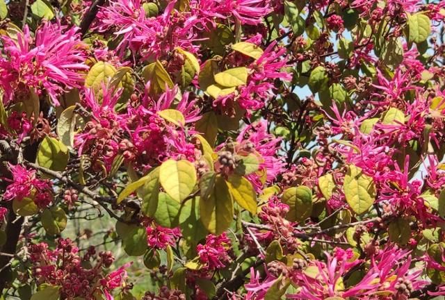 怎样去头油，2天不洗头头皮一大堆，去掉头油头皮屑，使用哪几个生活小妙招？图7