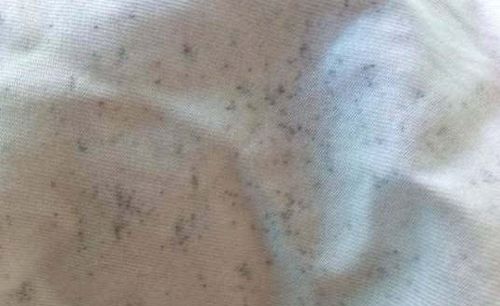 为什么穿衣服洗完之后后背衣服有霉点