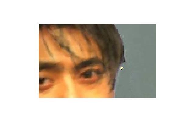 激发肾复苏的三大动作：有效帮助抢救肾复苏